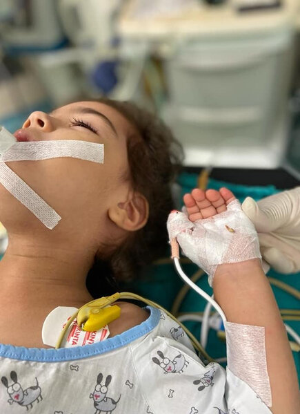 Bakıda 2 yaşlı uşaq bir il nəfəs borusunda sümük parçası ilə yaşayıb - FOTO