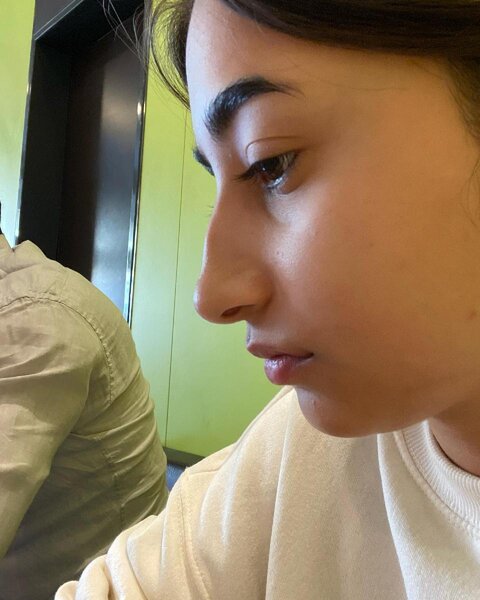 Sevgilisi azərbaycanlı blogeri döyüb - Fotolar