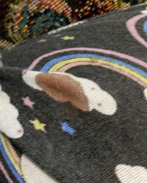 Sevgilisi azərbaycanlı blogeri döyüb - Fotolar