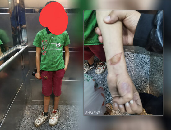 Küçədə tapılan uşaqla bağlı polisə müraciət olundu - FOTO