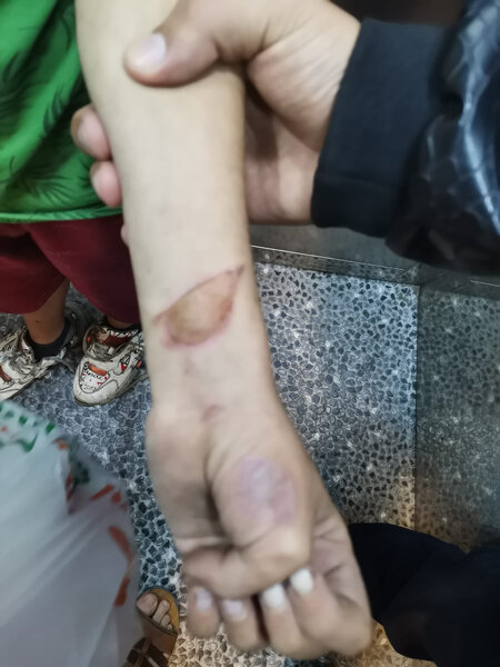 Küçədə tapılan uşaqla bağlı polisə müraciət olundu - FOTO