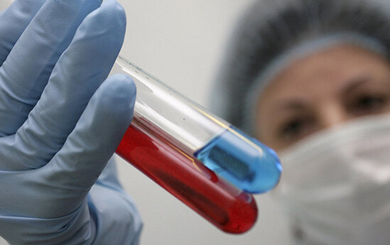 Yoluxanların sayı açıqlandı