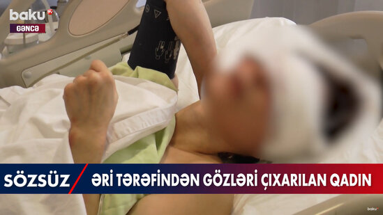 Əri tərəfindən gözləri çıxarılan qadının GÖRÜNTÜLƏRİ - VİDEO