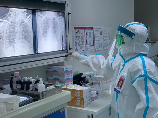 Azərbaycanda COVID-19-a yoluxanların sayı açıqlandı