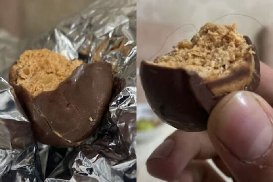 Şokolad aldı, içindən tük çıxdı - VİDEO