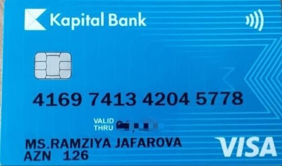 12 yaşlı Filizin anası: "Övladımın vəziyyəti çox pisdir" - FOTO