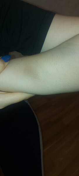 Küçədə qaçırılan qadınla bağlı ŞOK DETALLAR - Gələn gündən şiddət görür - FOTO - YENİLƏNİB