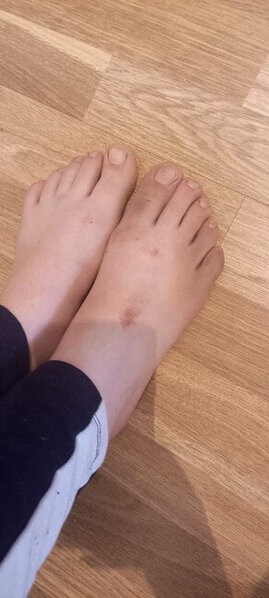 Küçədə qaçırılan qadınla bağlı ŞOK DETALLAR - Gələn gündən şiddət görür - FOTO - YENİLƏNİB