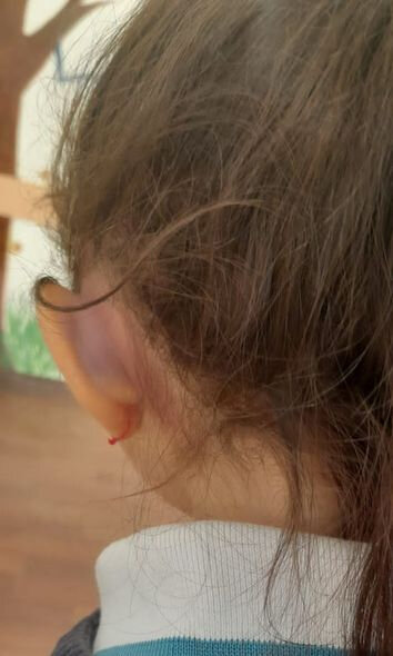 Yeddi yaşlı qız dəfələrlə şiddətə məruz qalıb - FOTO