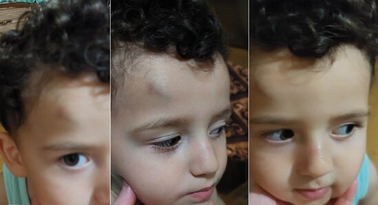 Azərbaycanda bağçada aylıq ödənişə görə 2 yaşlı uşağı döydülər - FOTO - VİDEO