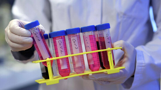 Son sutkada neçə nəfər koronavirusa yoluxub?