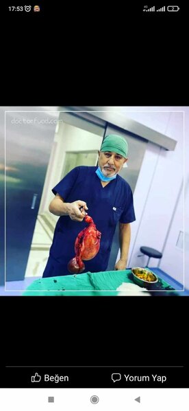 Həkim Fuad Nəzərovun sünnət zamanı cinsi orqanını zədələdiyi uşağın atası danışdı