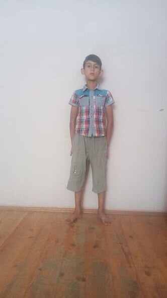 Leykozdan əziyyət çəkən Mübarizin anası: "Bəzən yeməyə heç nə tapmırıq, yardıma ehtiyacımız var" - FOTO