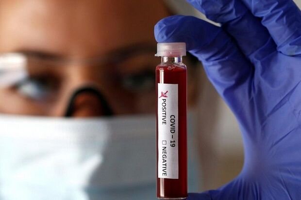 Azərbaycanda COVID-19-un yeni ştamları aşkarlanıb?