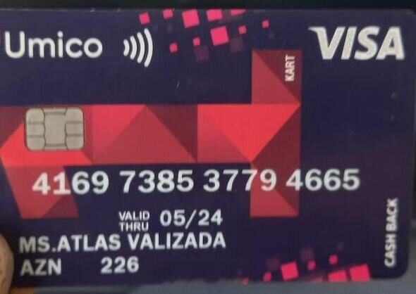 3 yaşlı Rənanın sizin dəstəyinizə ehtiyacı var: Müalicə olunmalıdır - FOTO