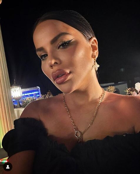 Bədəni çürüyən azərbaycanlı modeldən YENİ AÇIQLAMA - FOTO