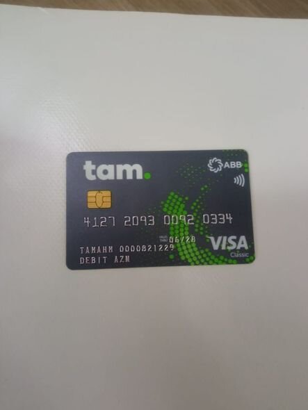 10 yaşlı Əsna əməliyyat olunmalıdır: 2 500 manata ehtiyacı var - FOTO