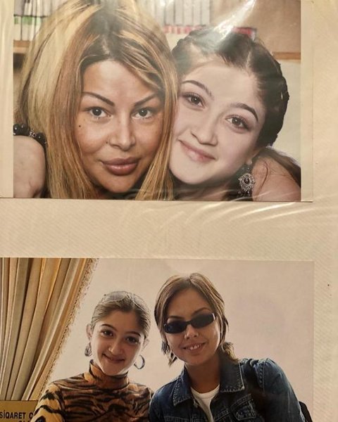 Aygün Kazımovanın 18 il əvvəlki makiyajsız şəklini paylaşdı