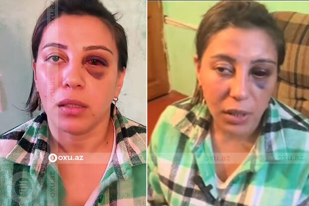 Əri tərəfindən döyülən qadınla bağlı araşdırma başladılıb - VİDEO