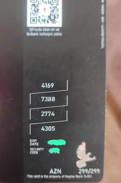 Oğlum 11 əməliyyat keçirib və hazırda bahalı müalicəyə ehtiyacı var - YARDIM ÇAĞIRIŞI - FOTO