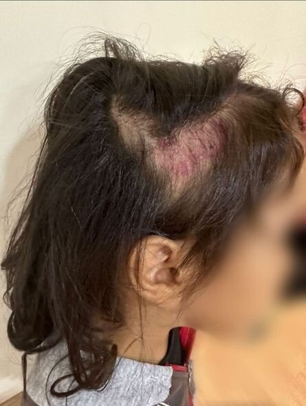 Bakıda dəhşət: Bacılara valideynləri tərəfindən işgəncə verilib - FOTO