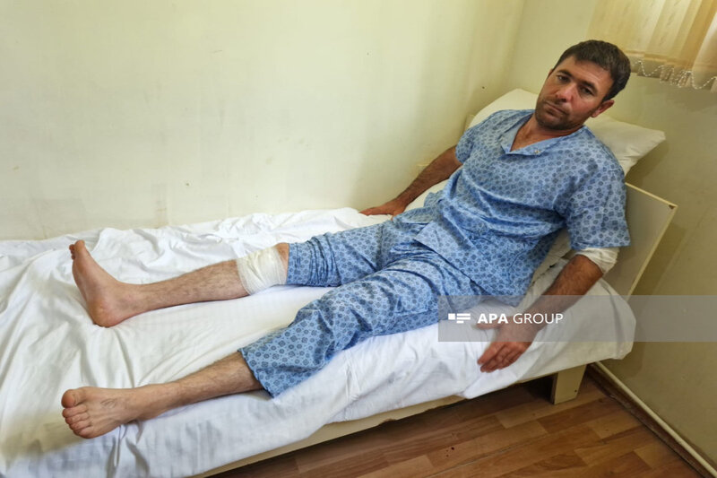 Ermənilərin Ağdamı atəşə tutması nəticəsində xəsarət alan ekskavatorçunun vəziyyəti açıqlanıb - FOTO