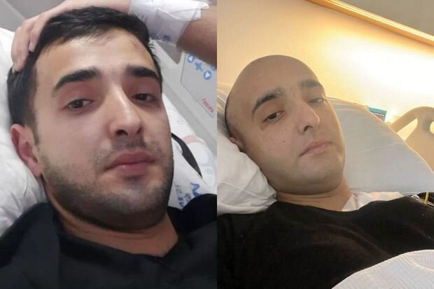 27 yaşlı gənc kəskin leykozdan əziyyət çəkir: Yaşamağa ümidi qalmayıb - FOTO