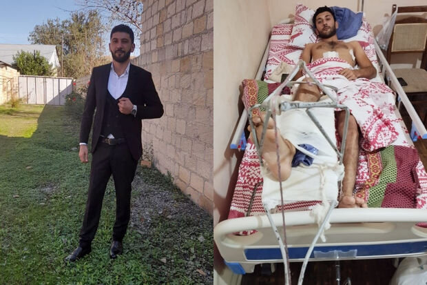 21 yaşlı Adil ağır qəzaya düşüb: Təcili əməliyyat olunmalıdır - FOTO/VİDEO
