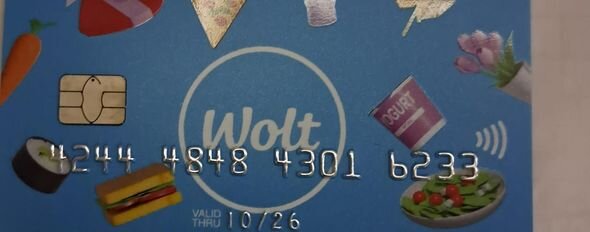 5 yaşlı Banunun dəstəyə ehtiyacı var: Əməliyyat üçün lazım olan məbləğin yarısı toplanıb - FOTO