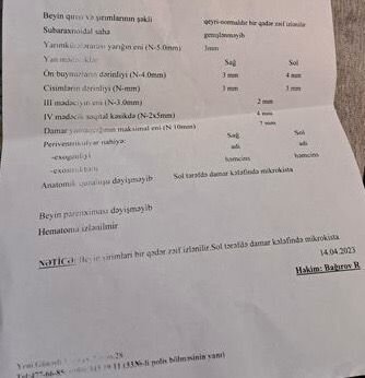 Başında kista olan səkkiz aylıq körpənin yardıma ehtiyacı var - FOTO