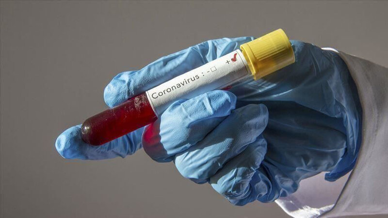 Azərbaycanda 39 koronavirus xəstəsi var