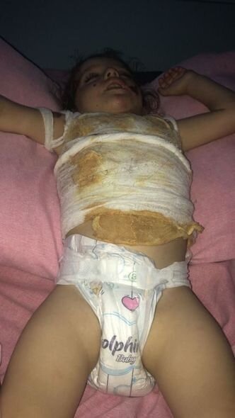 İki yaşlı Ayanın anası: "Nə dərman, nə də yemək almaq üçün pulum qalmayıb" - FOTO