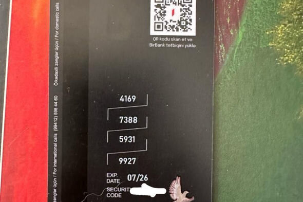 İki yaşlı Asimin əlləri yanıb: Müalicə üçün 500 manat lazımdır - FOTO