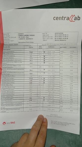 2 yaşlı Həmzənin anası fəryad edir: "Övladıma ət almağa belə pulum yoxdur" - FOTO