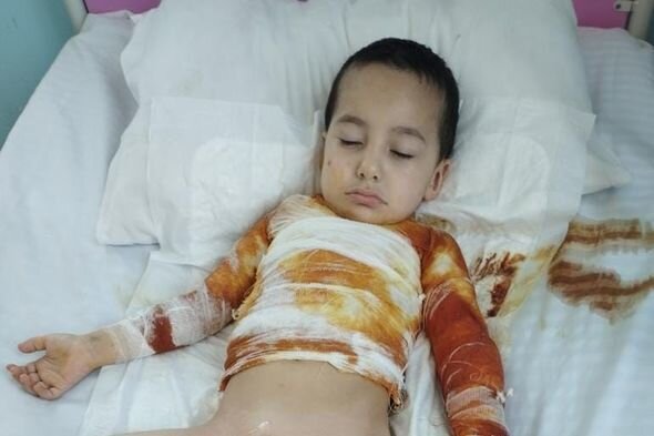 Bədəni yanan azyaşlının atası: "Uşaqlar bayramda Şaxta babanın onlara hədiyyə gətirməsini gözləyirlər" - FOTO