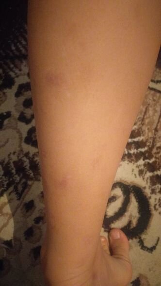 Qonşu 10 yaşlı uşağı vəhşicəsinə döyüb - İDDİA + FOTO/VİDEO