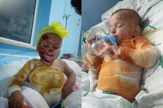 Balaca Zəhranın anası fəryad edir: "Bint almağa belə pulum qalmayıb" - FOTO