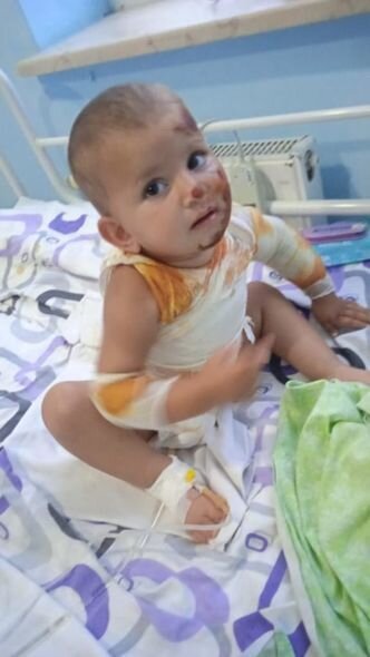 Balaca Zəhranın anası fəryad edir: "Bint almağa belə pulum qalmayıb" - FOTO