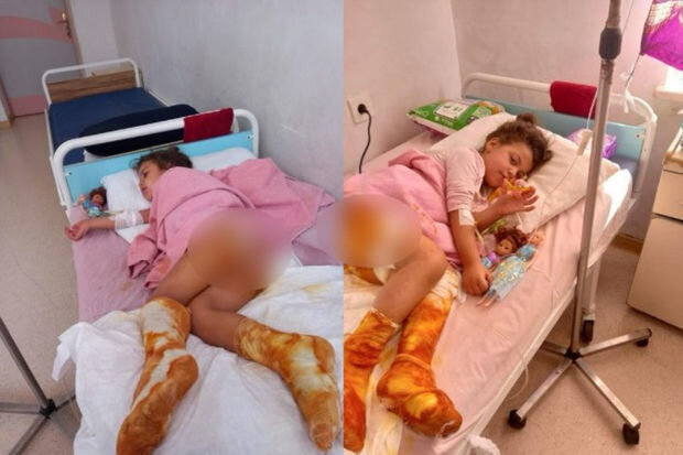 6 yaşlı Leylanın anası fəryad edir: "Üç gündür yaralarını təmizləməyə maz ala bilmirəm" - FOTO