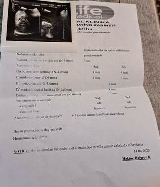 10 aylıq körpənin anası fəryad edir: "Melisa mənim ilk və tək övladımdır, onu itirməkdən qorxuram" - FOTO