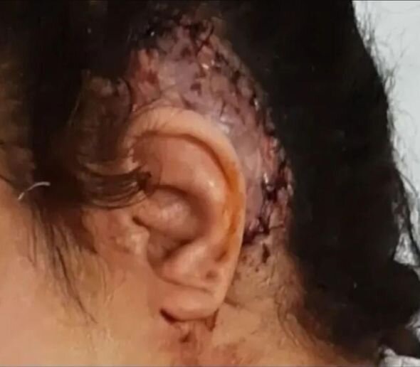 20 yaşlı Ayselin anası fəryad edir: "Övladımı ölümün pənçəsindən xilas etməyiniz üçün yalvarıram" - FOTO