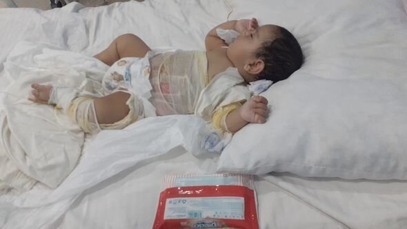 Bir yaşlı körpə qaynar suda yanıb: Müalicə üçün dəstəyə ehtiyacı var - FOTO