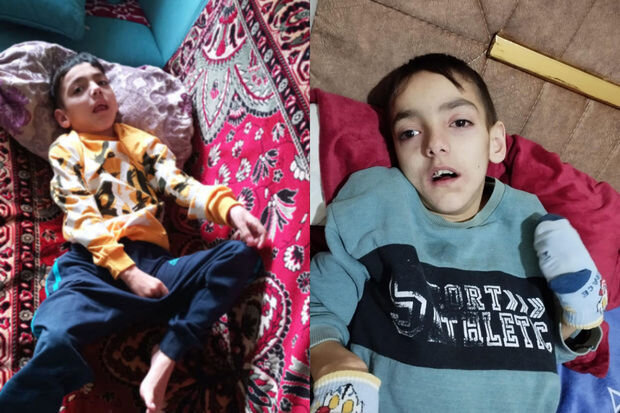 12 yaşlı Ömərin 200 manata ehtiyacı var: Anası yardım diləyir - FOTO