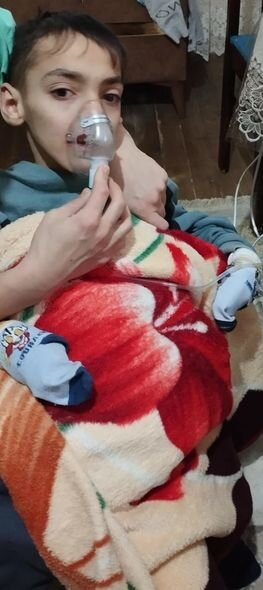 12 yaşlı Ömərin 200 manata ehtiyacı var: Anası yardım diləyir - FOTO