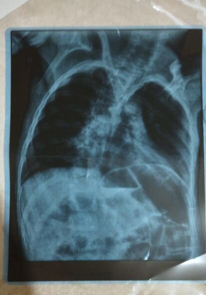 12 yaşlı Ömərin 200 manata ehtiyacı var: Anası yardım diləyir - FOTO