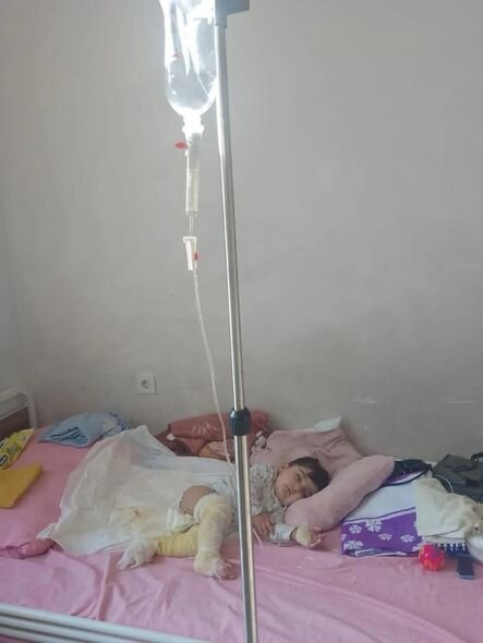 Körpə Muradın dəstəyə ehtiyacı var: Üzərinə qazan aşırdaraq yanıb - FOTO