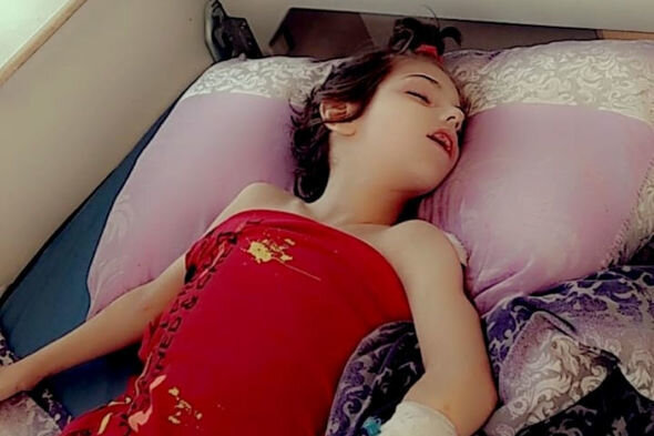 Yeddi yaşlı Zəhranın dəstəyə ehtiyacı var: "Nə dərmanlarını, nə də bezlərini ala bilirəm" - FOTO