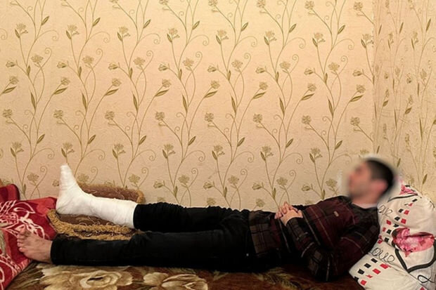 Bakıda "Azəriqaz"ın əməkdaşına xəsarət yetirilib - FOTO