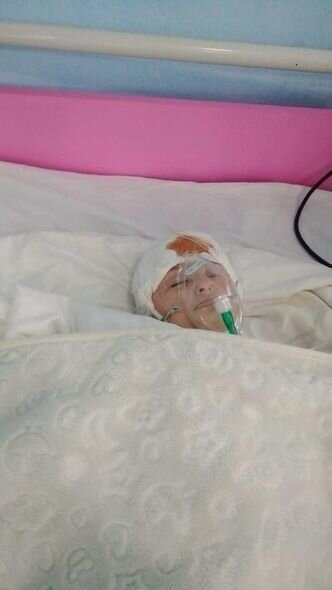 Yanğında xəsarət alan iki yaşlı Zeynəbin sizin köməyinizə ehtiyacı var - FOTO