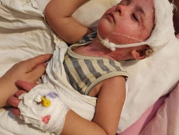 Yanğında xəsarət alan iki yaşlı Zeynəbin sizin köməyinizə ehtiyacı var - FOTO